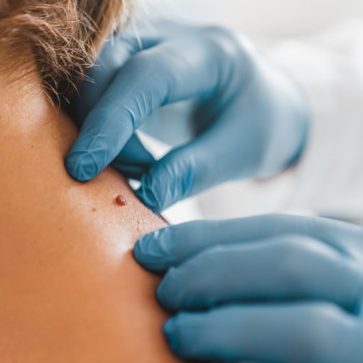 Miscellaneous Procedures